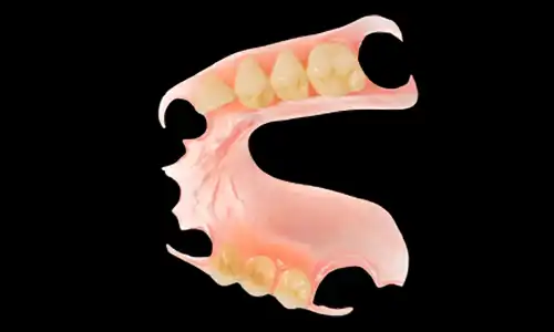 What Should Buyers Compare When Sourcing Valplast Dentures?